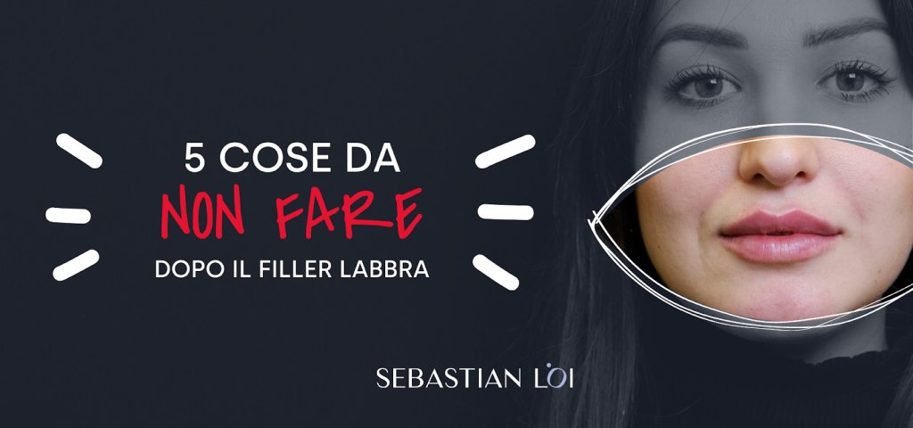 Cosa non fare dopo filler labbra